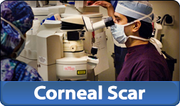 Corneal Scar Surgery